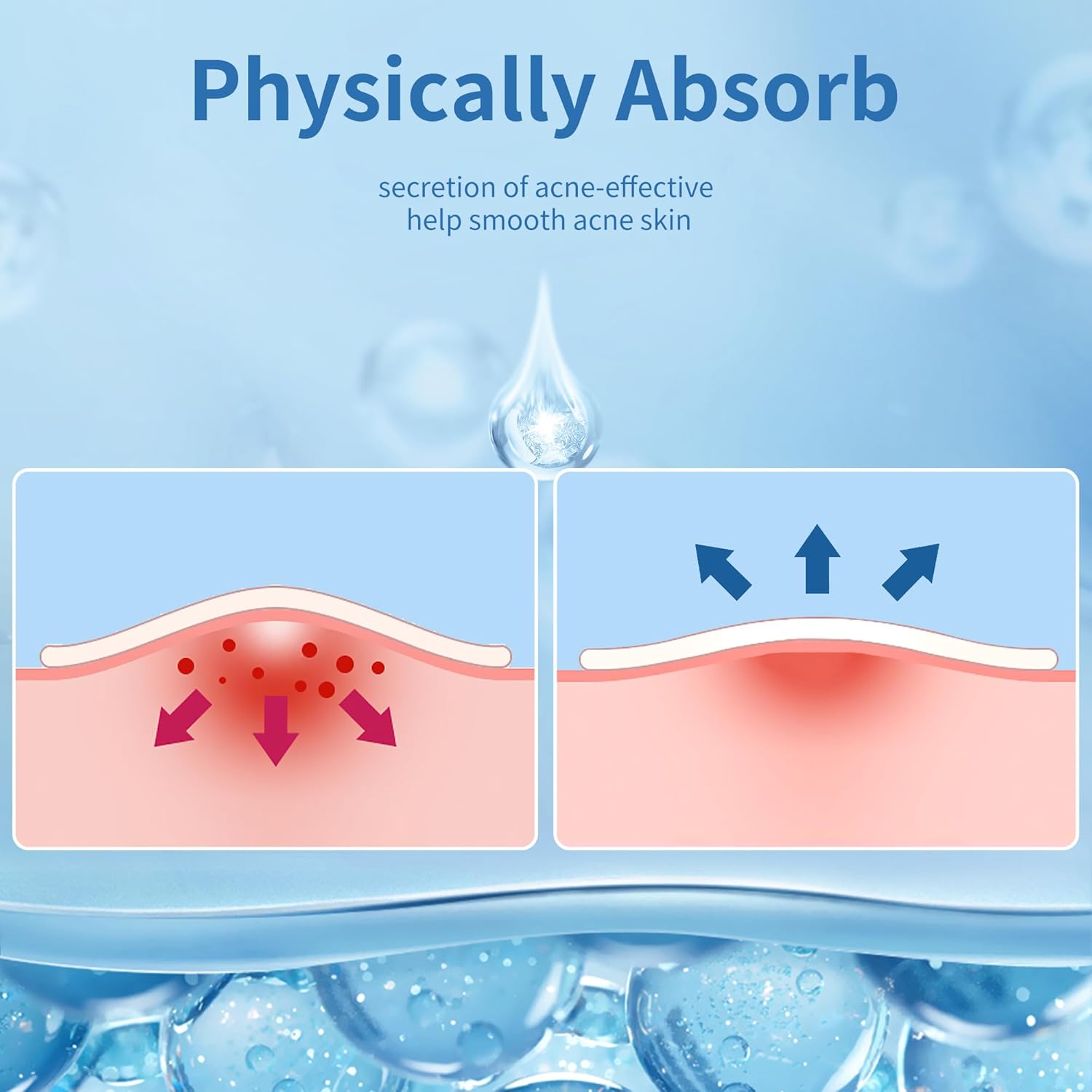 Spuogų pleistriukai, 300 vnt.