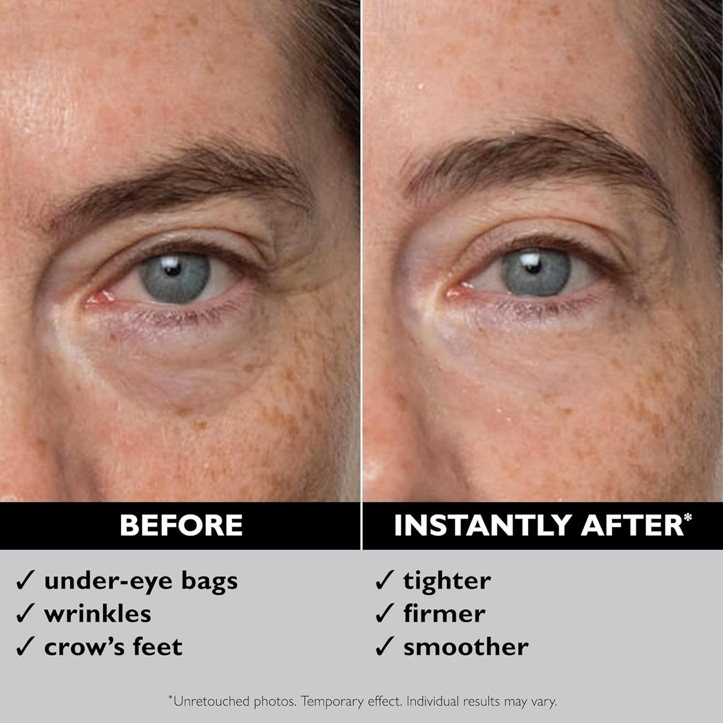 Peter Thomas Roth Instant FIRMx Temporary Eye Tightener paakių stangrinamasis kremas, 30 ml