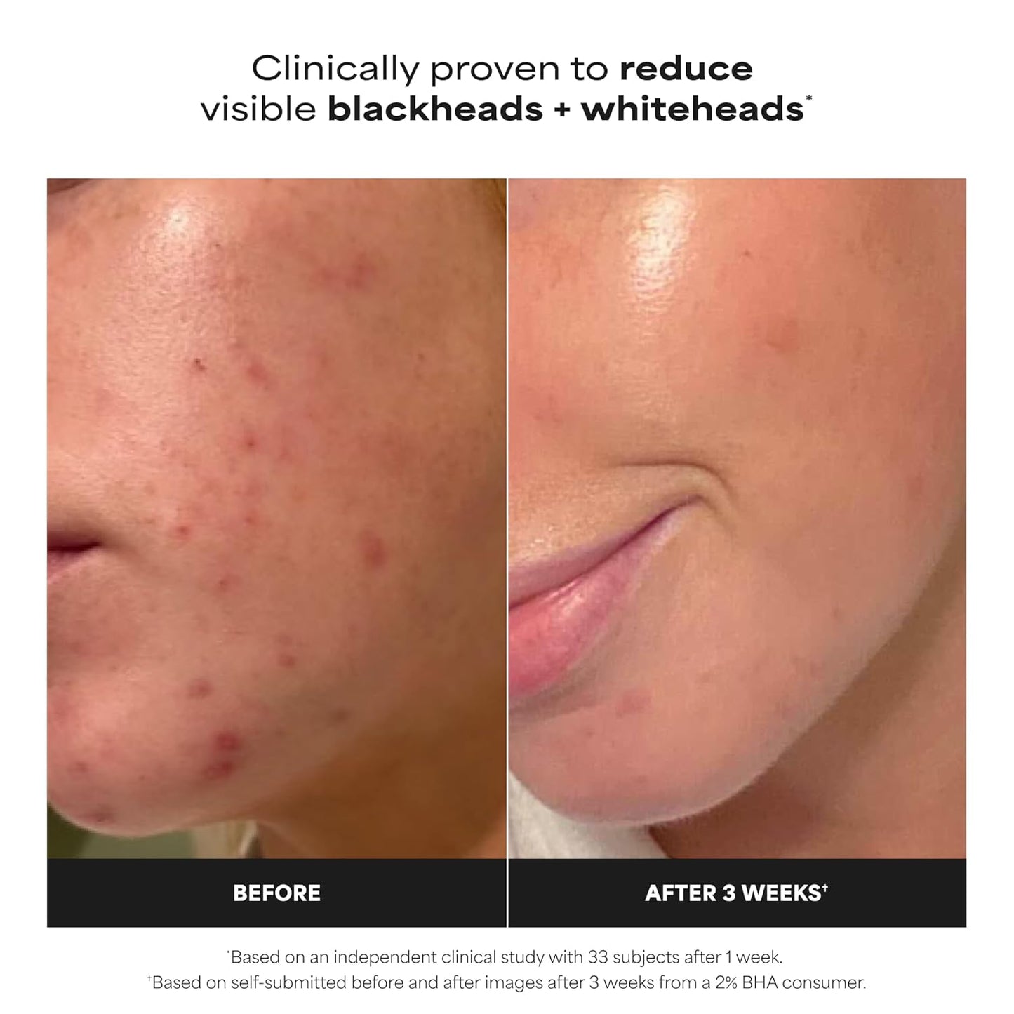 Paula's Choice SKIN PERFECTING 2% BHA skystas šveitiklis su salicilo rūgštimi
