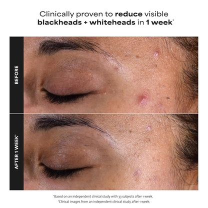 Paula's Choice SKIN PERFECTING 2% BHA skystas šveitiklis su salicilo rūgštimi