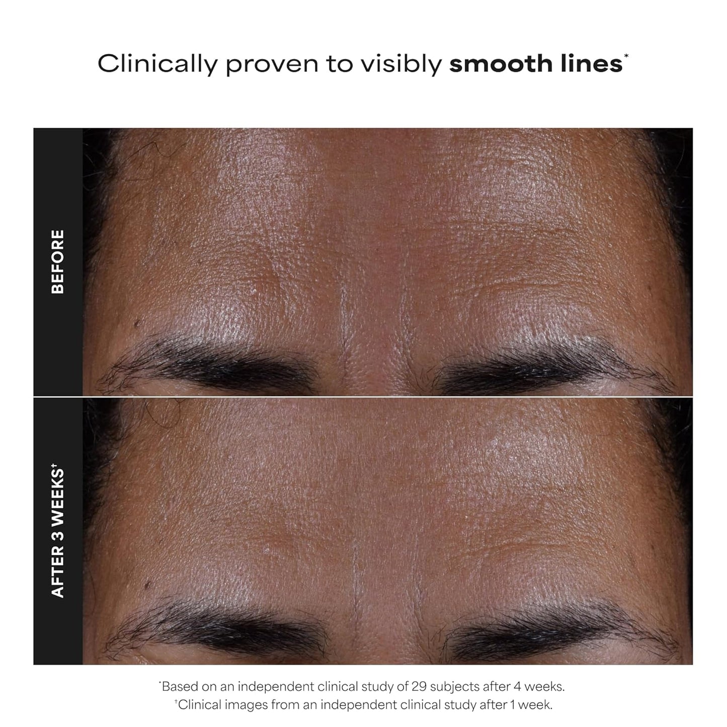 Paula's Choice SKIN PERFECTING 2% BHA skystas šveitiklis su salicilo rūgštimi