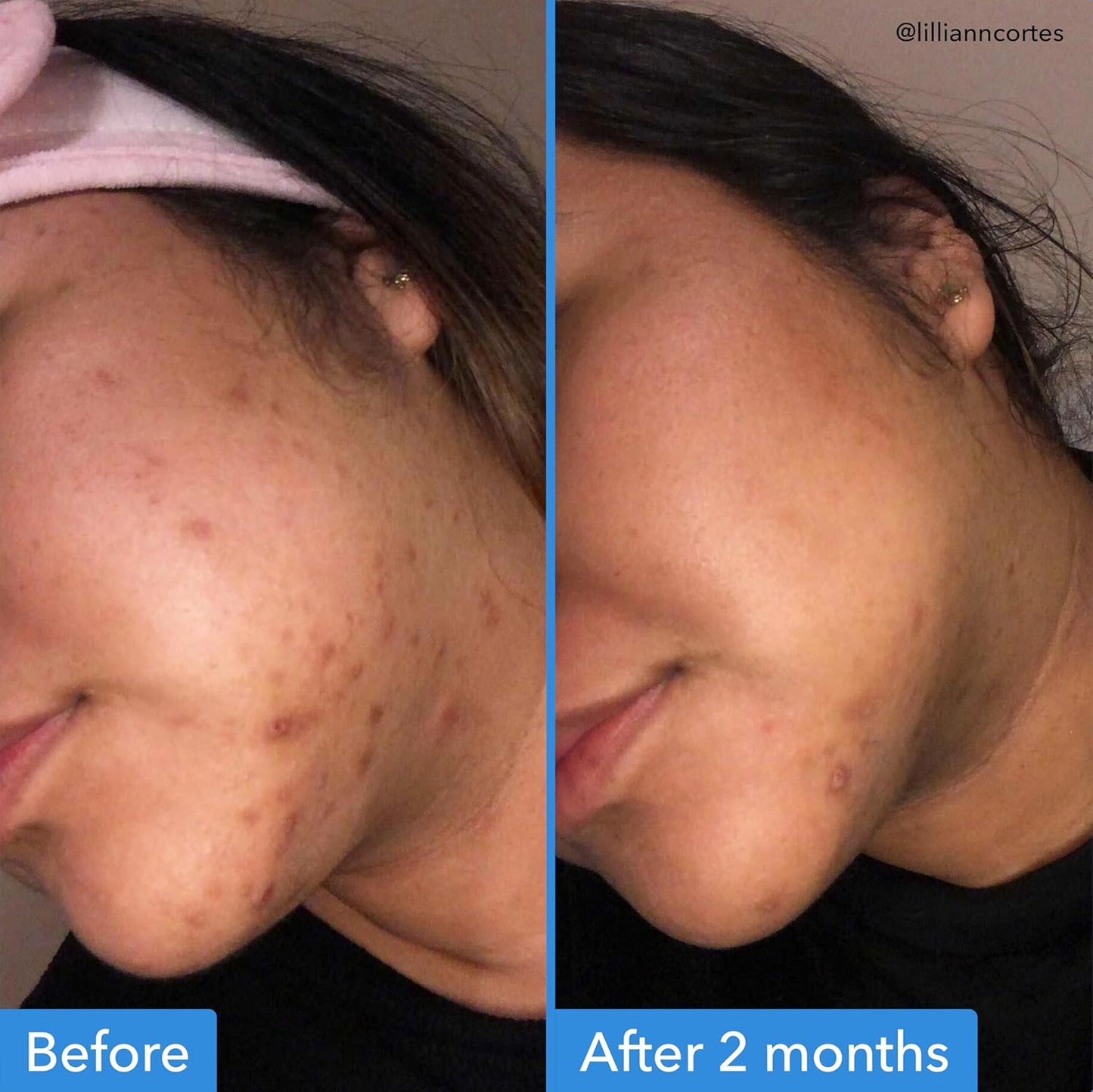 Good Molecules Discoloration Correcting Serum serumas nuo pigmentinių dėmių ir hiperpigmentacijos